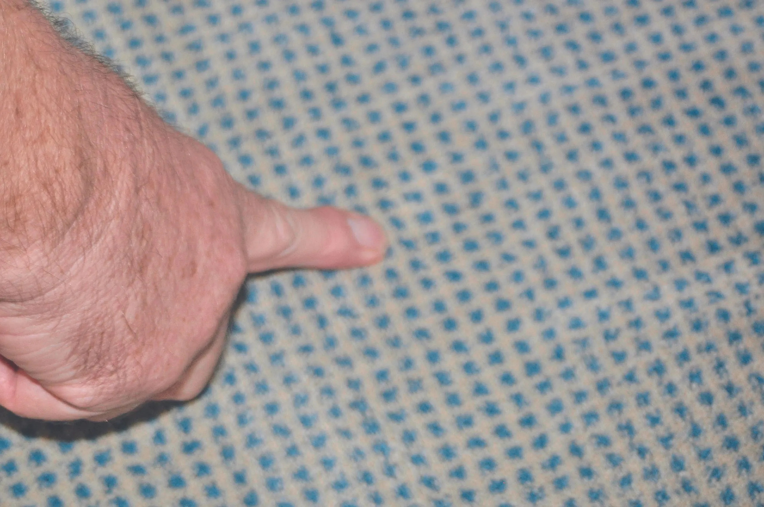 Fleckenstreit im Verwaltungsbau Verfleckungen